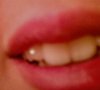 Dentista basso costo